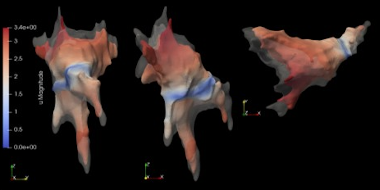 CFD simulation of airflow in a nasal cavity for biomedical research